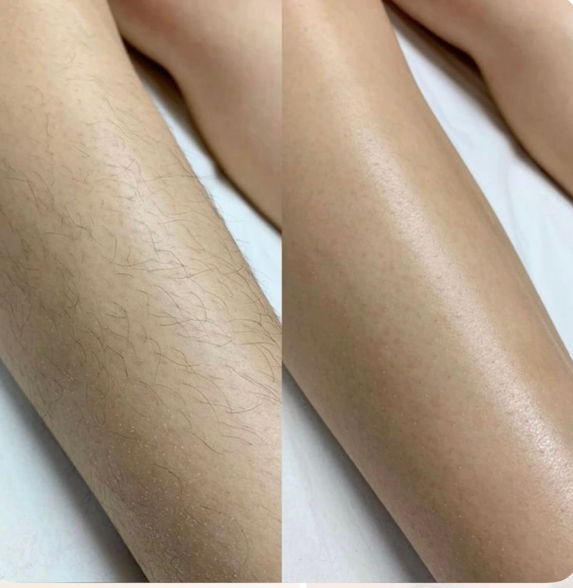 Waxing